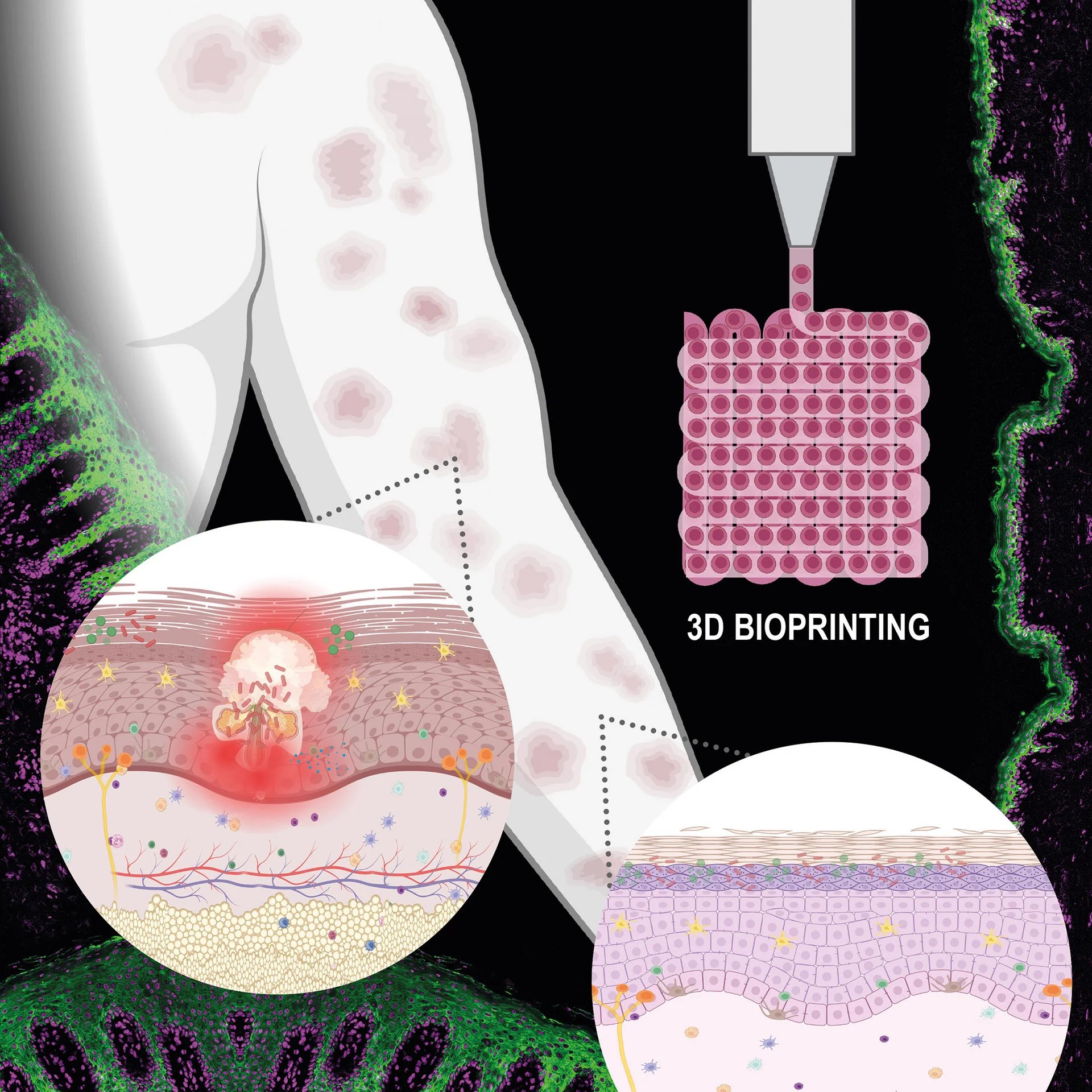 Grafische Darstellung von einem Arm; eine Pipette die ein Quadrat aufträgt und zwei Kreise, die Hautschichten zeigen.